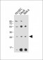 RPS4Y1 Antibody (Center)